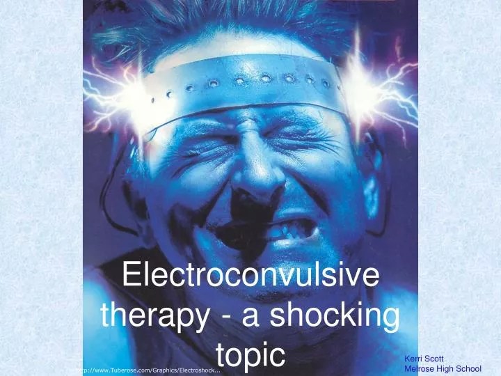 PPT Electroconvulsive therapy a shocking topic PowerPoint Presentation ID6773712