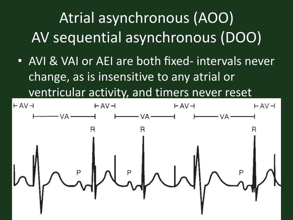 PPT PACEMAKER BASICS PowerPoint Presentation, free download ID6777433