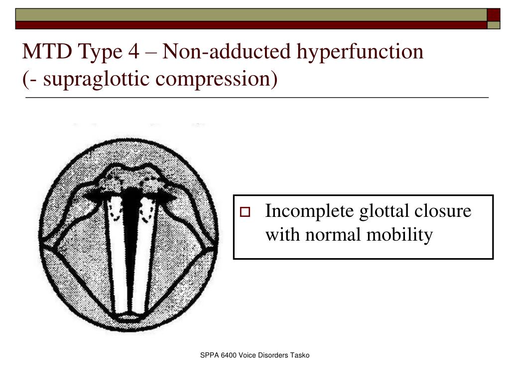 PPT Functional Dysphonia/ Muscle Tension Dysphonia (MTD) PowerPoint