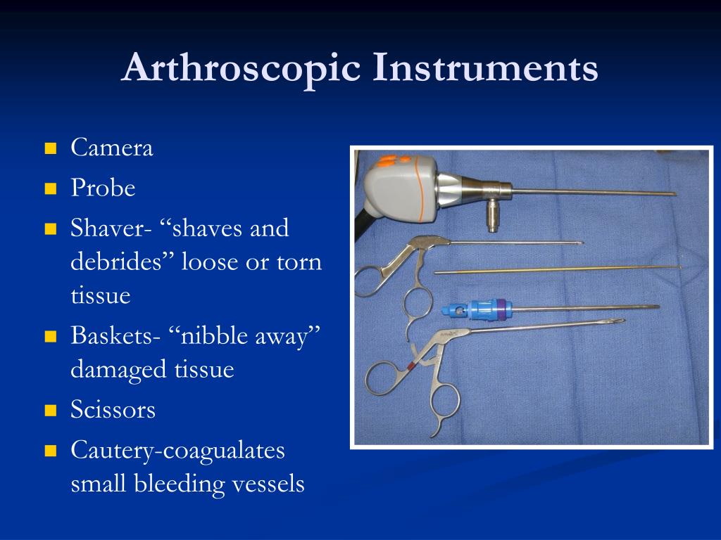 PPT Knee Arthroscopy PowerPoint Presentation, free download ID6813293