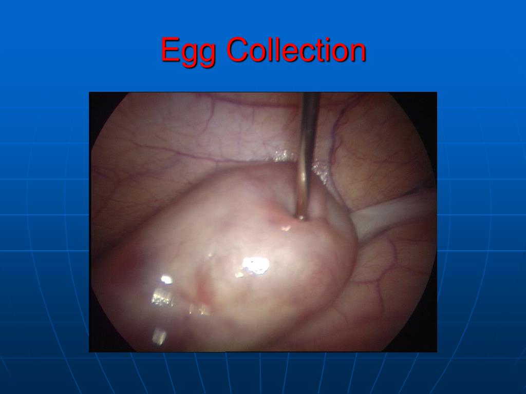 PPT MRKH & IVF SURROGACY PowerPoint Presentation, free download ID6865780