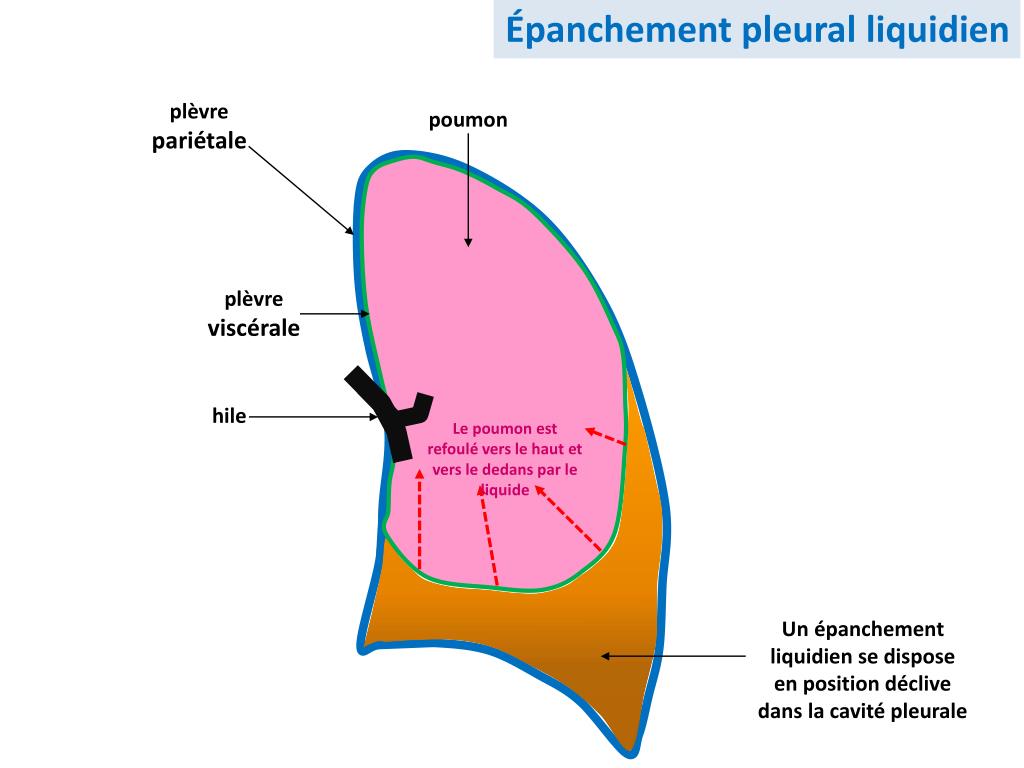 PPT Pr CharlesHugo Marquette PowerPoint Presentation, free download