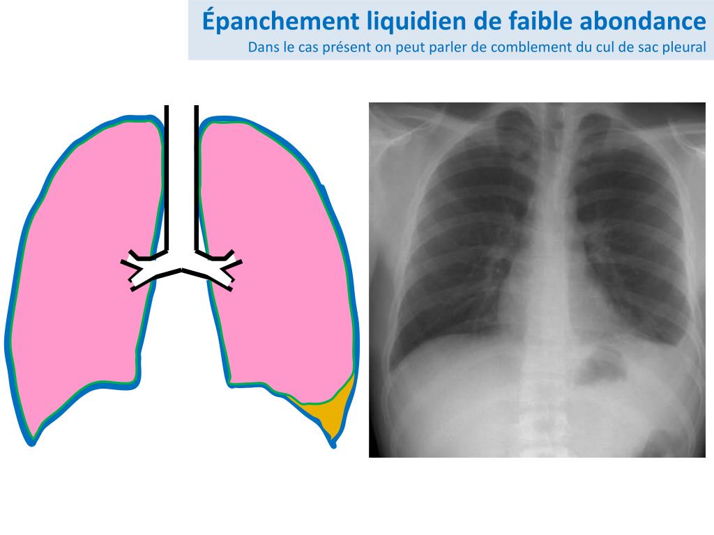 PPT Pr CharlesHugo Marquette PowerPoint Presentation, free download