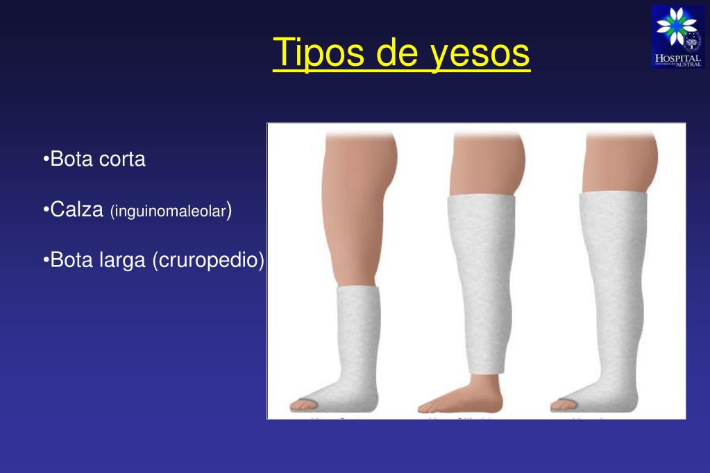 PPT Procedimientos en OyT PowerPoint Presentation, free download ID