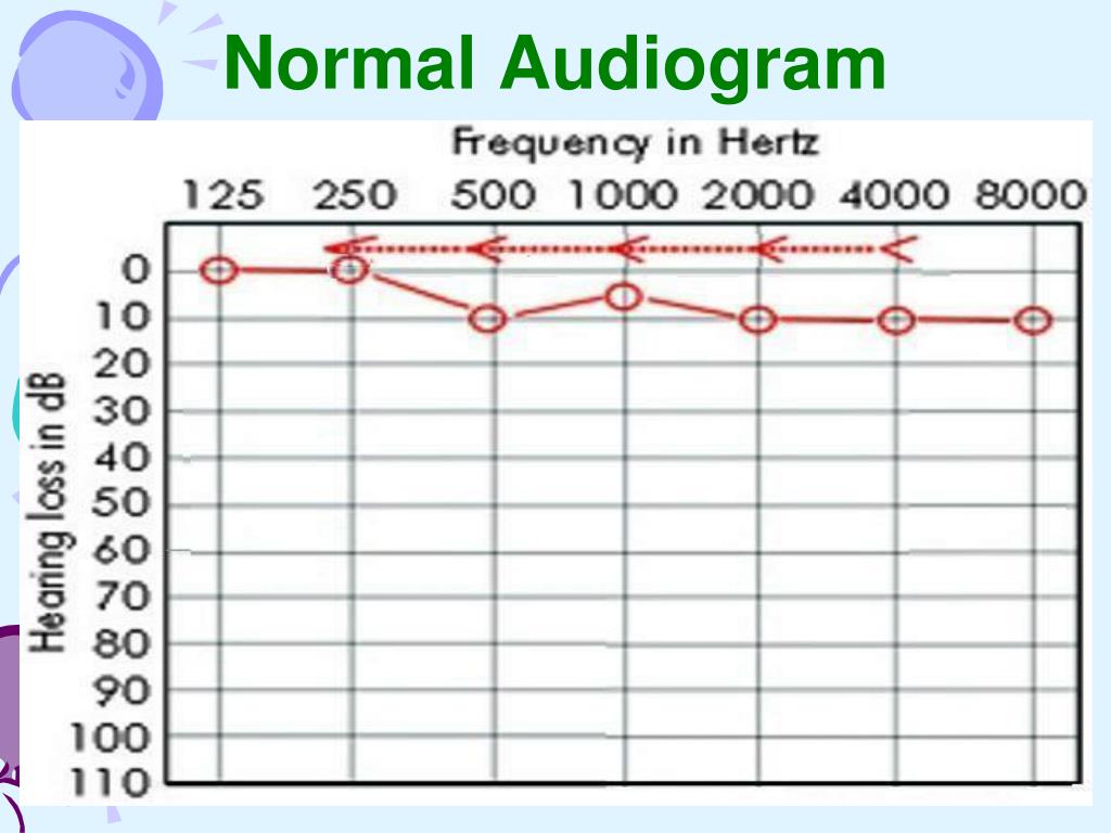 PPT Audiometry PowerPoint Presentation, free download ID6912897