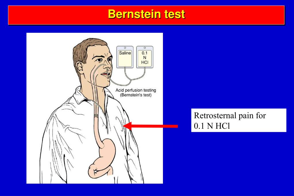 PPT DISEASES OF THE ESOPHAGUS PowerPoint Presentation, free download