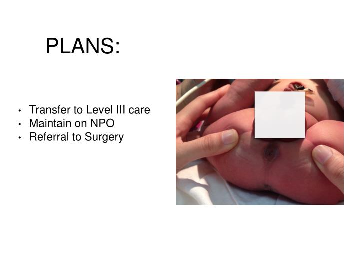 PPT Imperforate Anus PowerPoint Presentation ID6919535