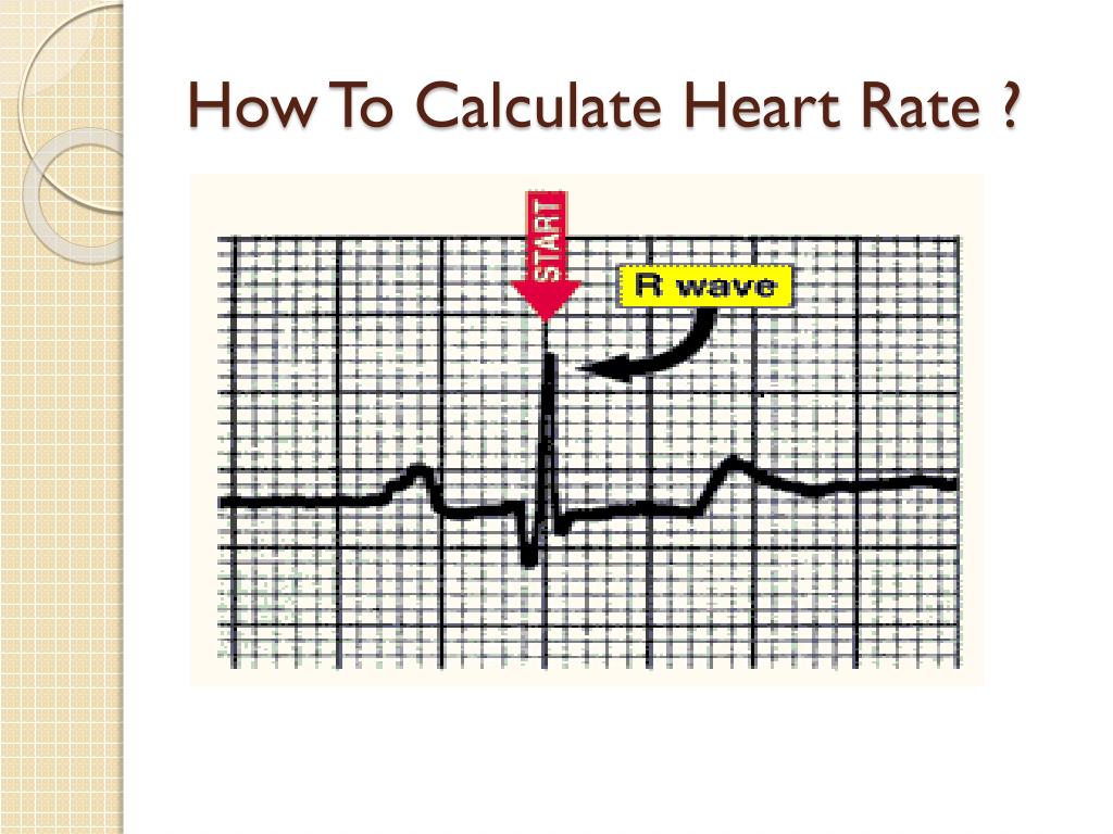 PPT ECG PowerPoint Presentation, free download ID6925472