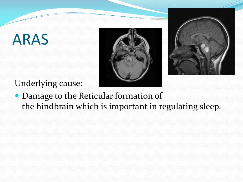 PPT Coma PowerPoint Presentation, free download ID6934726