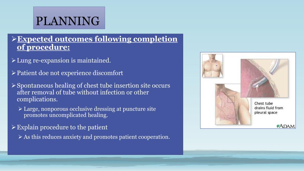 PPT NUR 232 SKILL 262 Assisting with Removal of Chest Tubes PowerPoint Presentation ID6936094