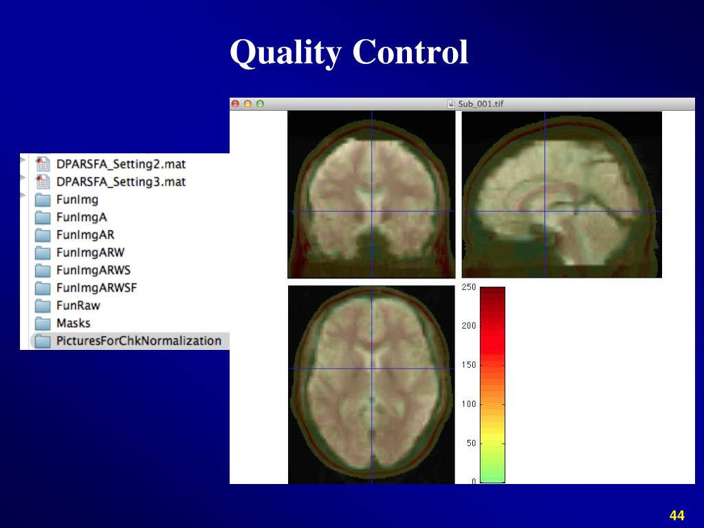 PPT Data Processing & Analysis of RestingState fMRI ( Part II