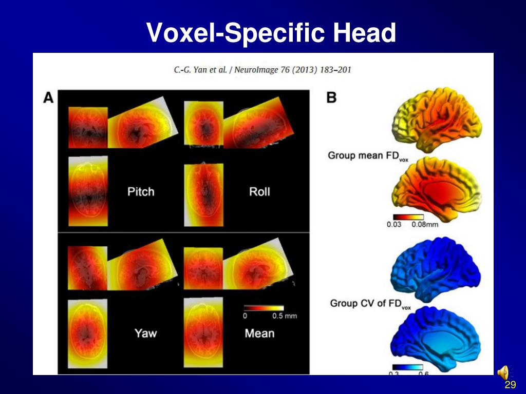 PPT Data Processing & Analysis of RestingState fMRI ( Part II