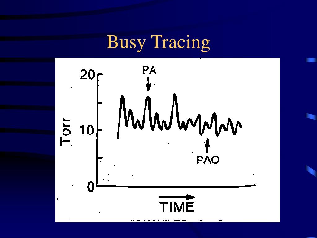 PPT Hemodynamic Monitoring PowerPoint Presentation, free