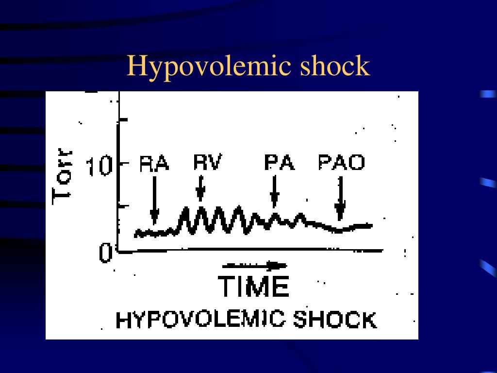PPT Hemodynamic Monitoring PowerPoint Presentation, free