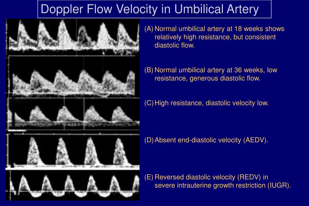 PPT Doppler Ultrasonography in Obstetrical Practice PowerPoint