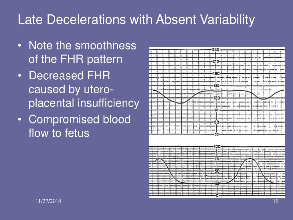 PPT Basic Fetal Monitoring Review PowerPoint Presentation, free
