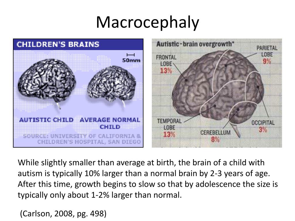 PPT Autism and the Brain PowerPoint Presentation ID6972523