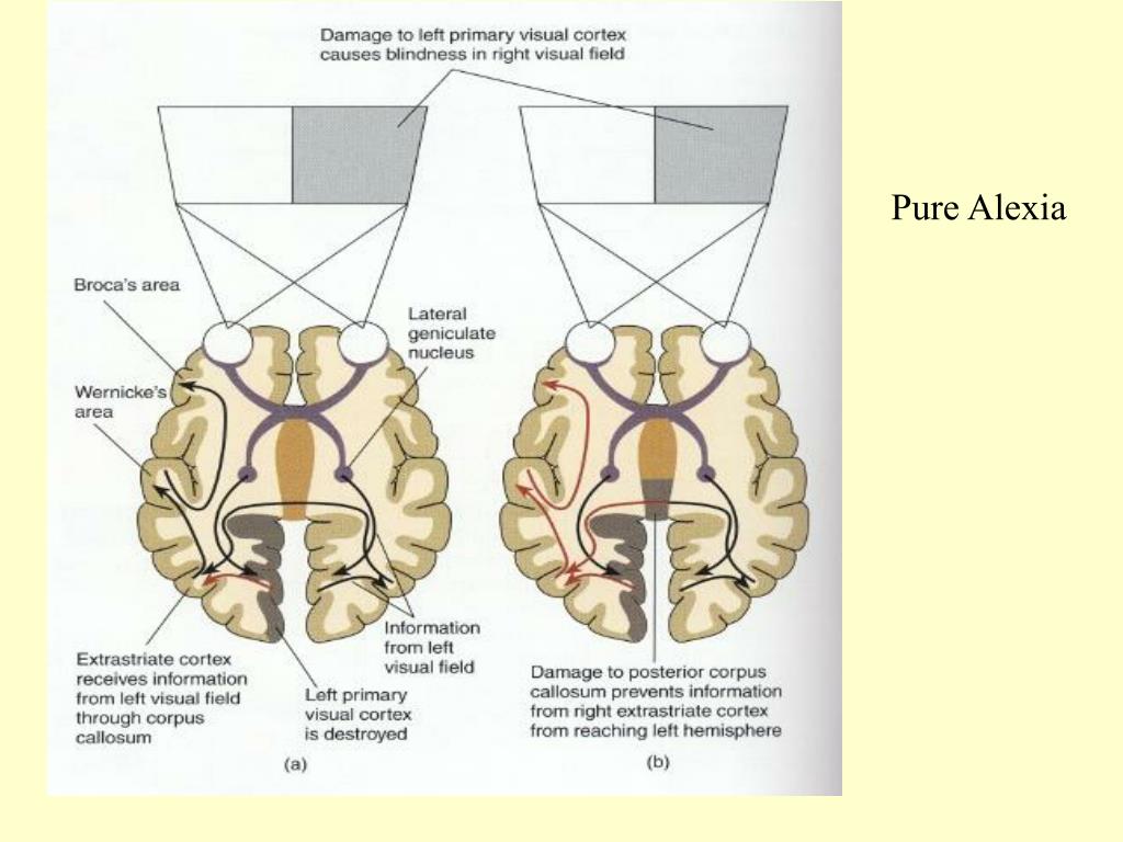PPT Brain lateralization vision & sensory/motor systems that why