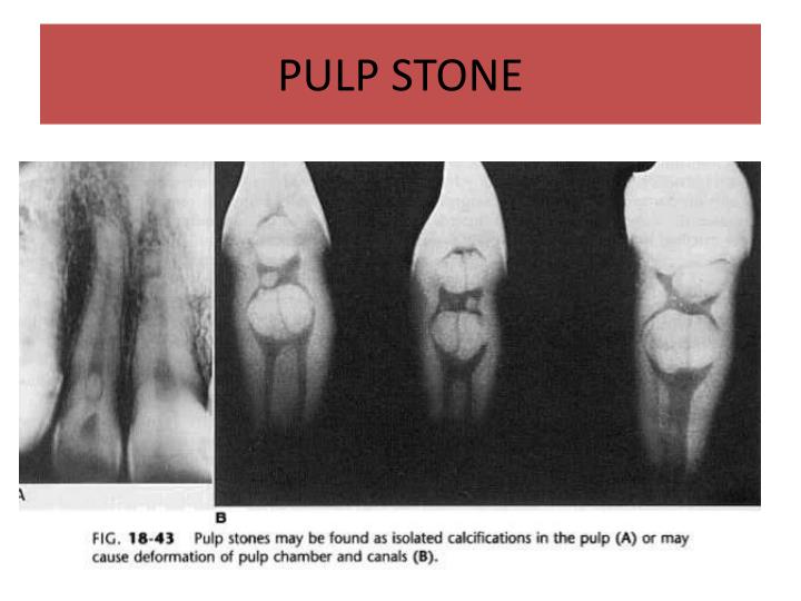 PPT DENTAL ANOMALY PowerPoint Presentation ID7007534