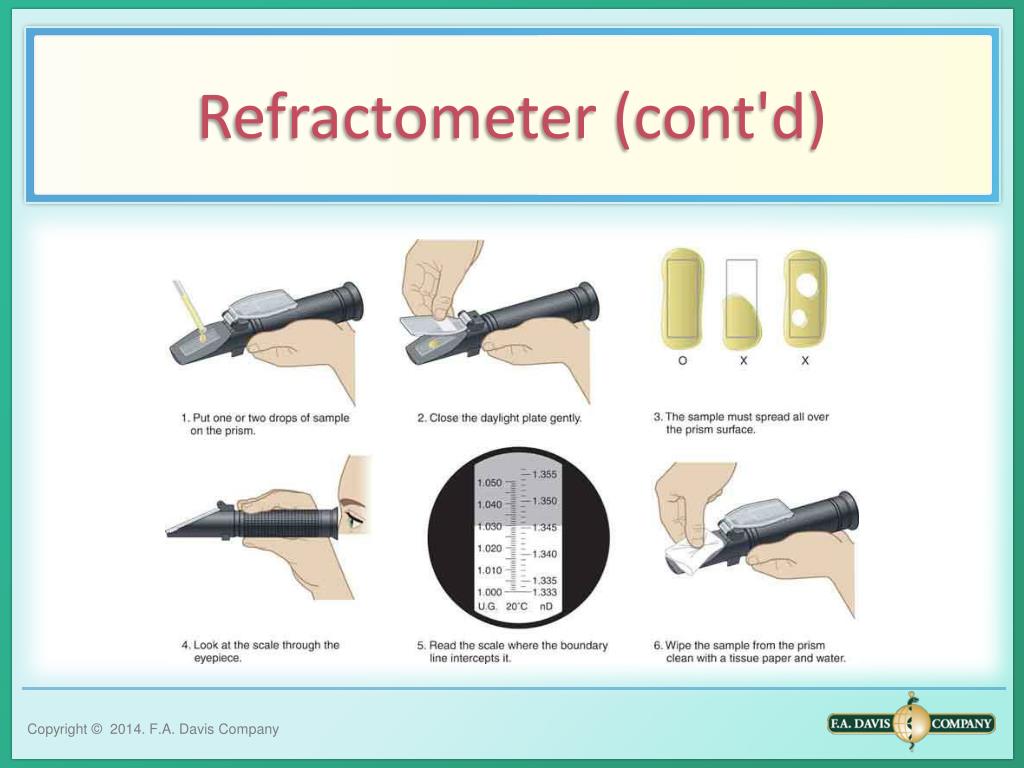 PPT PHYSICAL EXAMINATION OF URINE PowerPoint Presentation, free