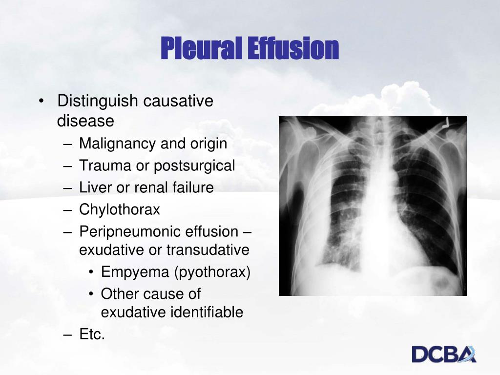 PPT Value Based Purchasing. Changes for ICD10 and the Impact of Pathology Robert S. Gold. MD