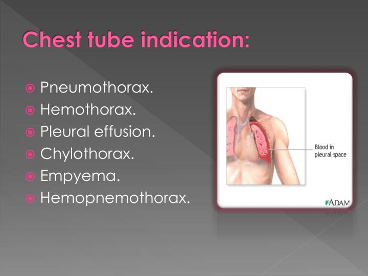 PPT Chest Tube PowerPoint Presentation ID7066708