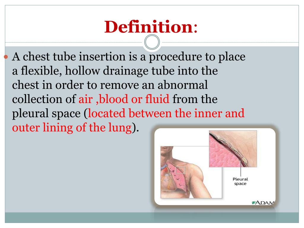 PPT Chest Tube PowerPoint Presentation, free download ID7066708