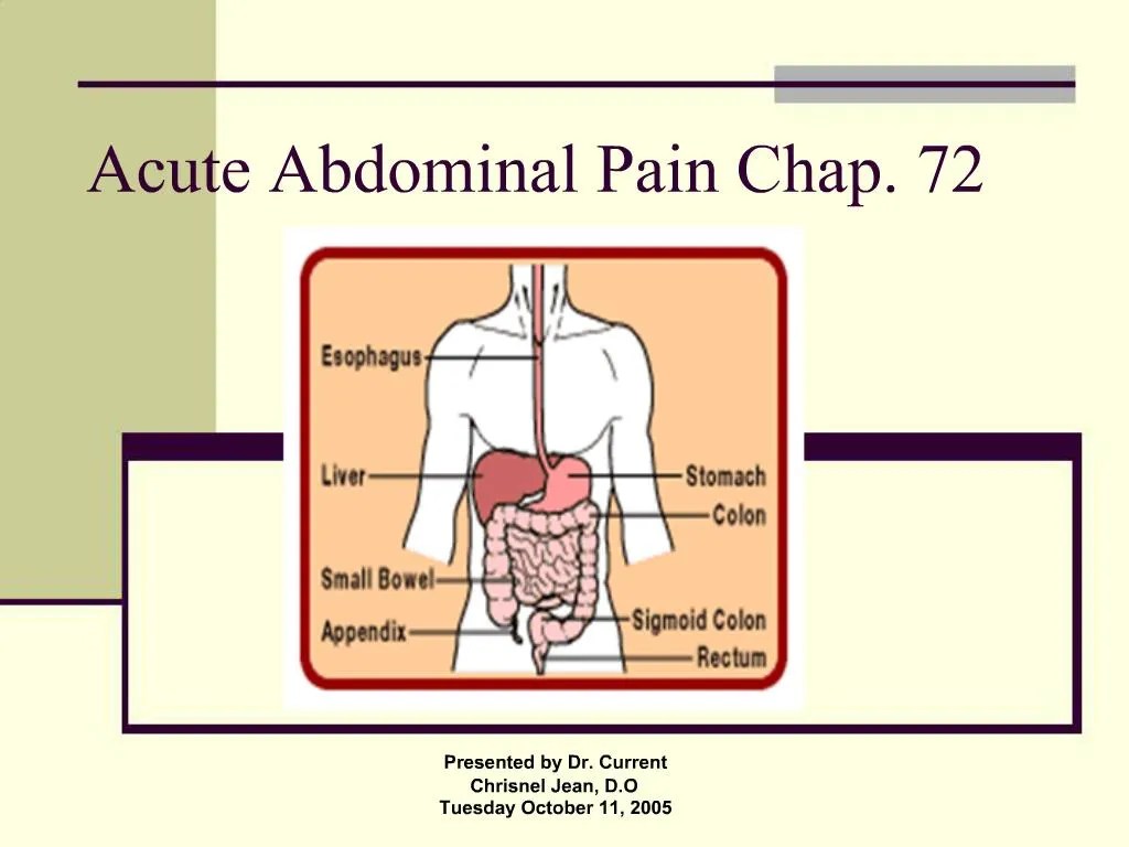 PPT Acute Abdominal Pain Chap. 72 PowerPoint Presentation, free