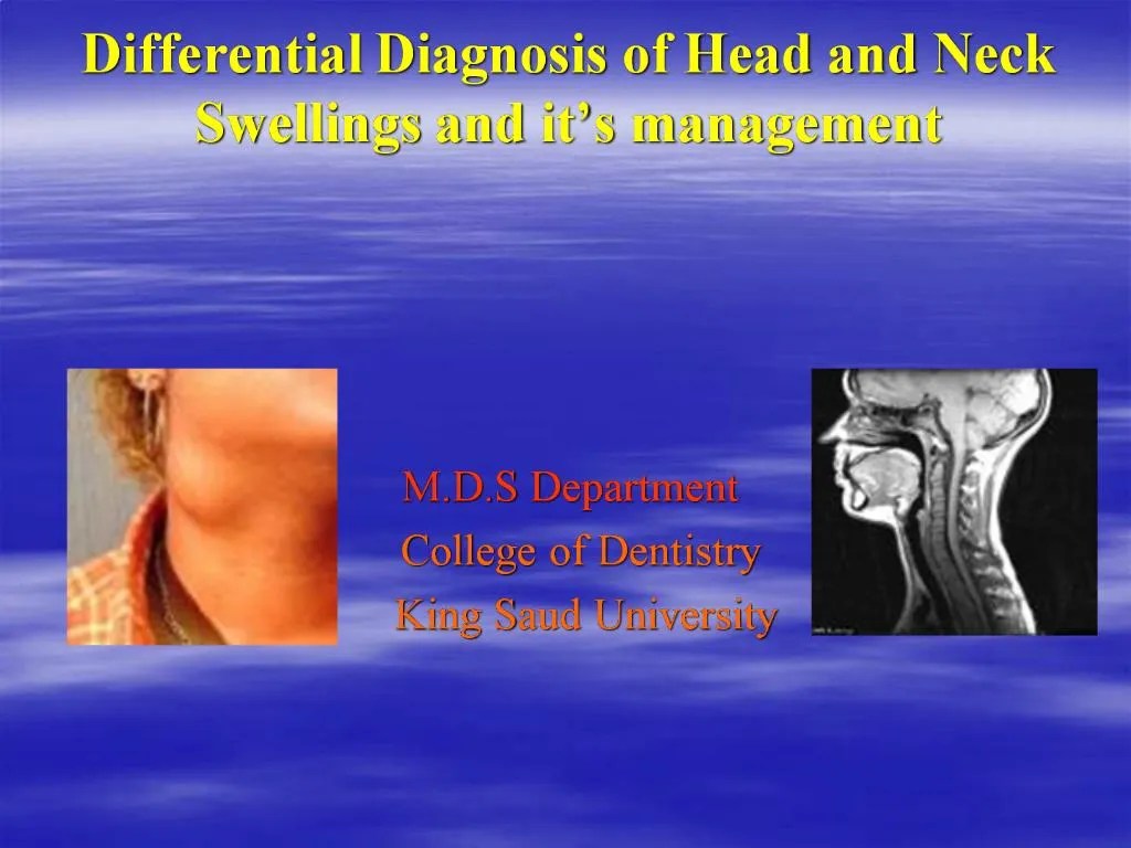 PPT Differential Diagnosis of Head and Neck Swellings and it s