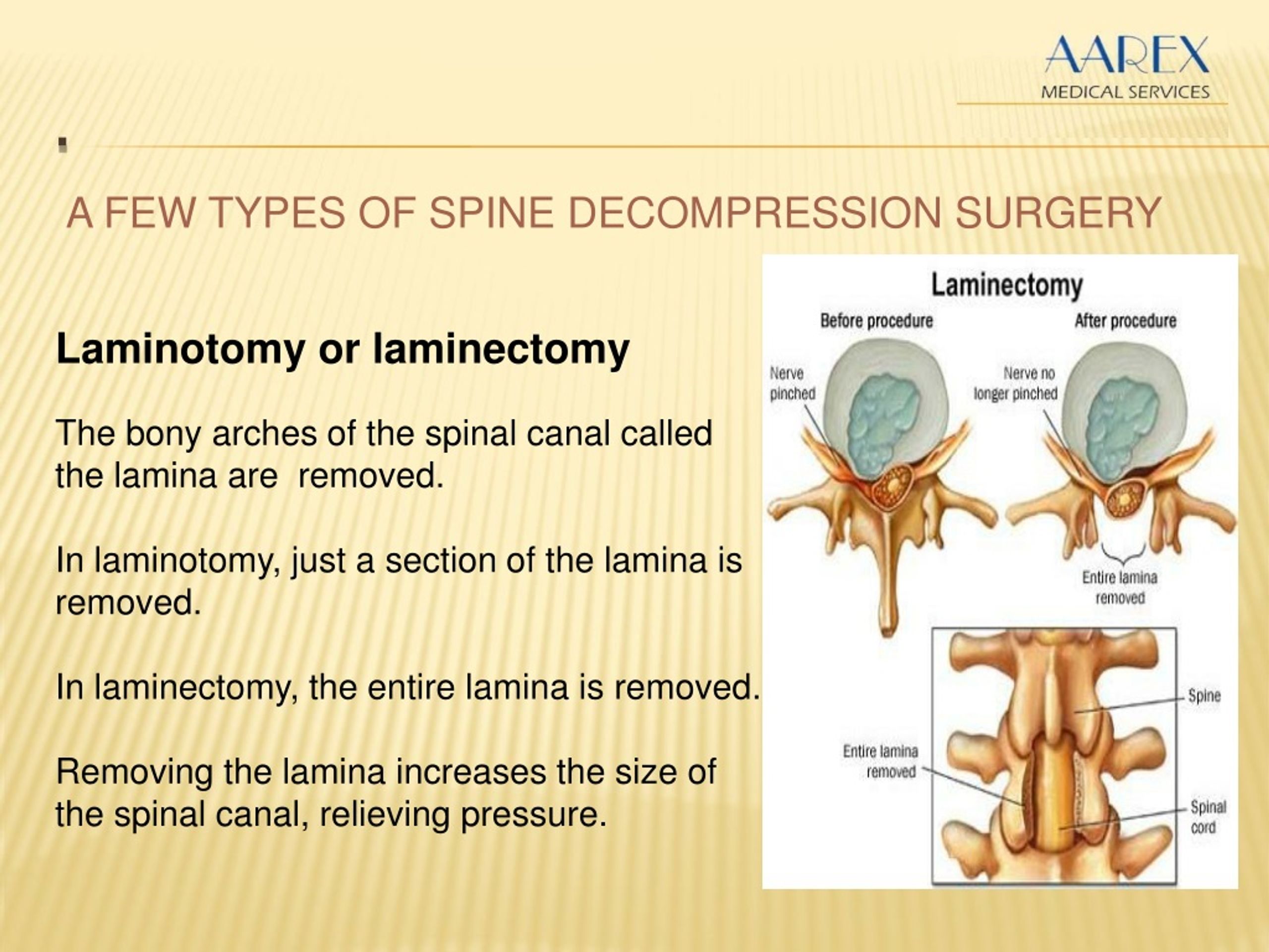 PPT Spine Surgery PowerPoint Presentation, free