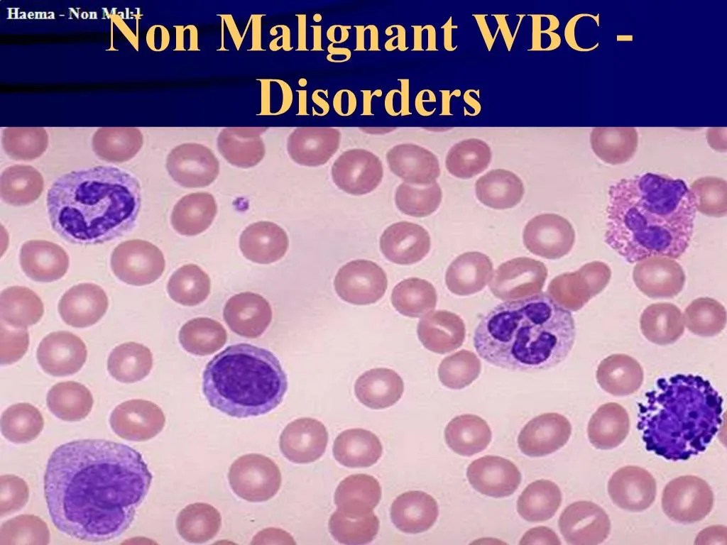 PPT Non Malignant WBC Disorders PowerPoint Presentation, free