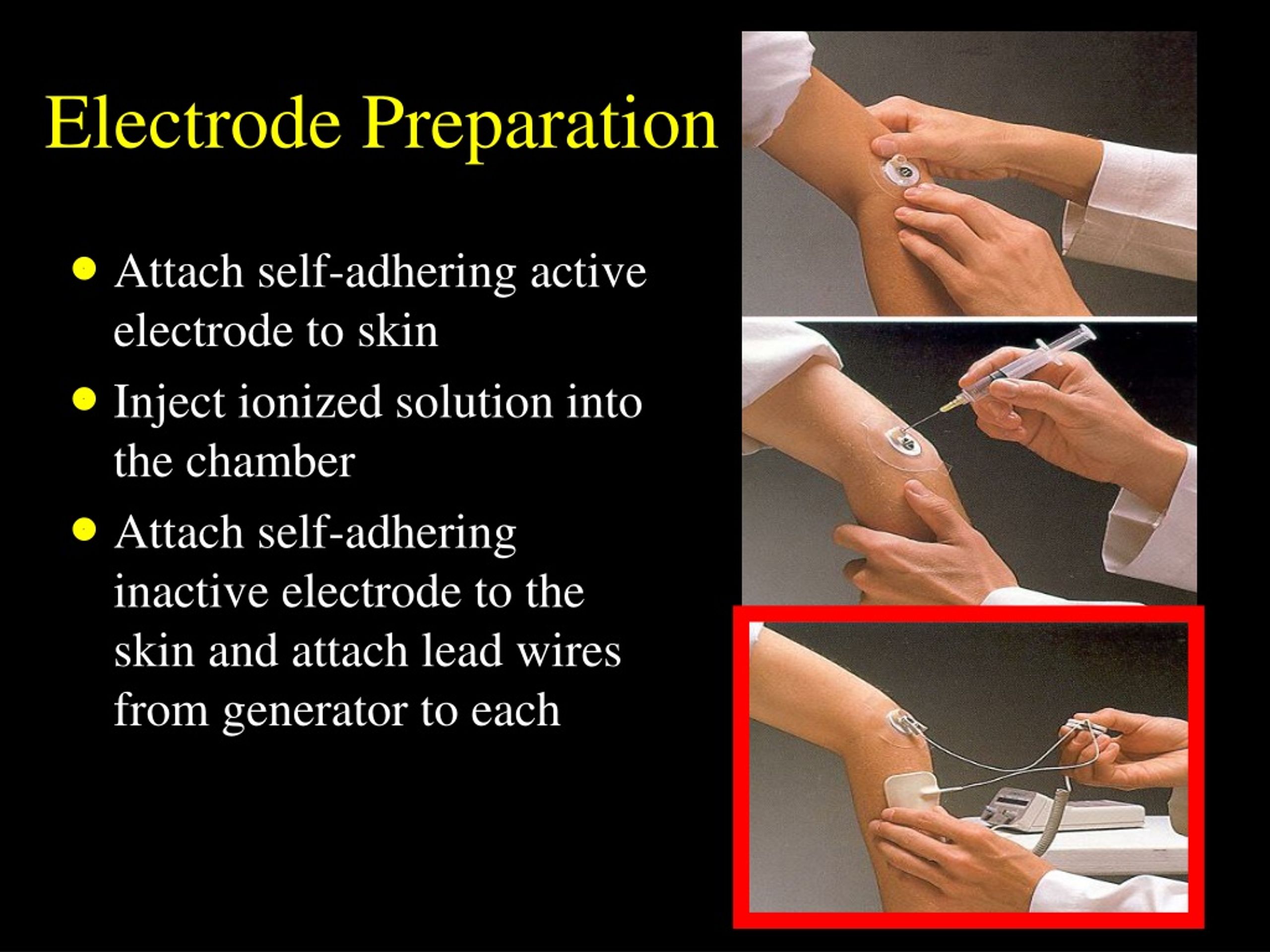PPT Iontophoresis PowerPoint Presentation, free download ID149649