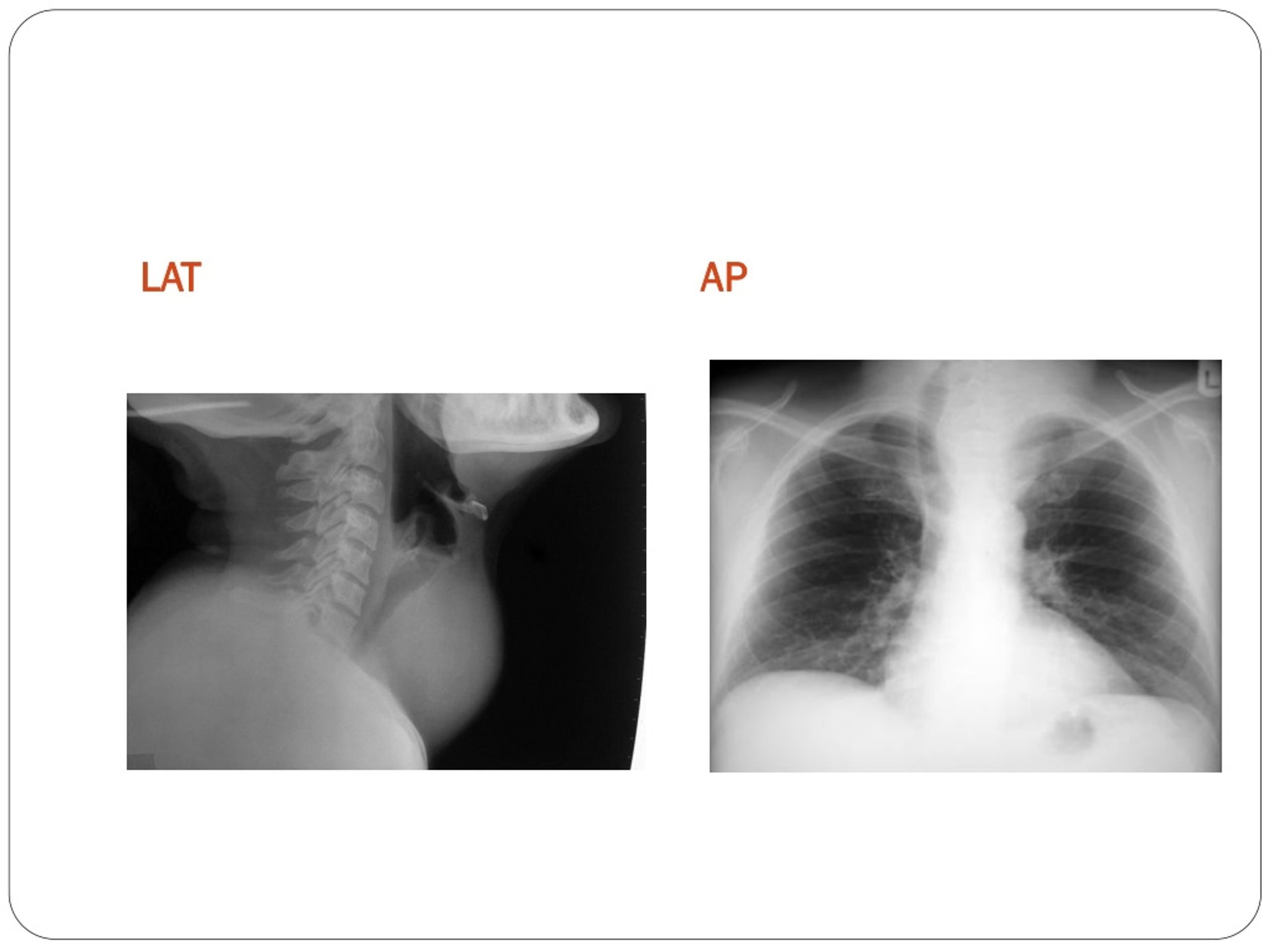 PPT DIFFERENTIAL DIAGNOSIS OF ANTERIOR NECK SWELLING