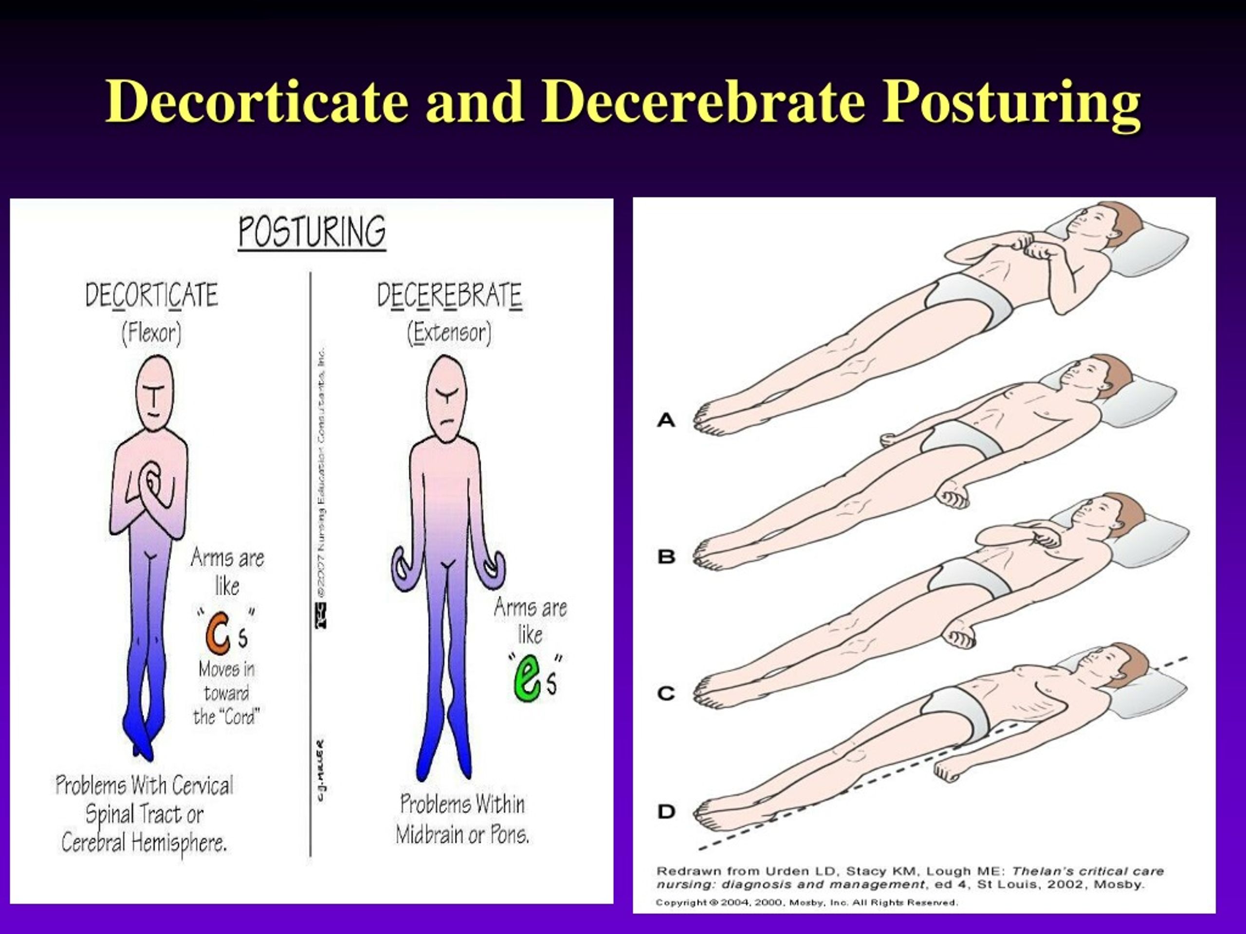 PPT INTRACRANIAL PRESSURE PowerPoint Presentation, free download ID