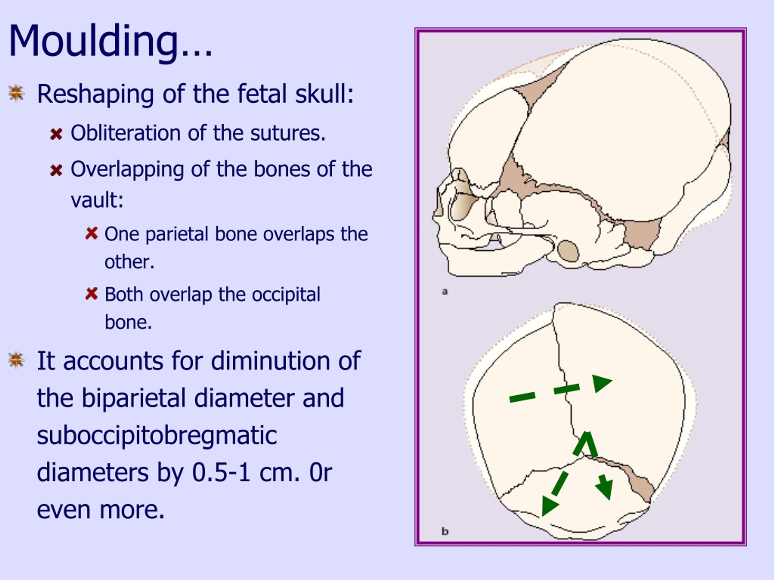 PPT Bony pelvis and fetal skull Dr Malleswar Rao K PowerPoint Presentation ID229959