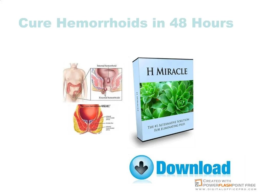 PPT Cure Hemorrhoids in 48 Hours PowerPoint Presentation, free