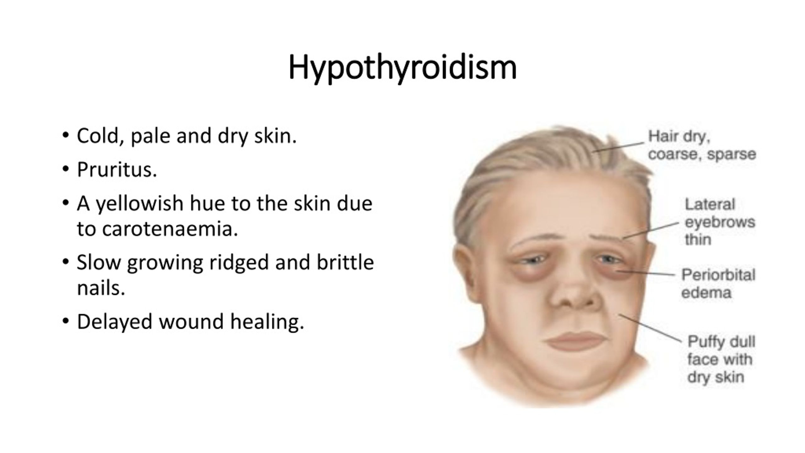 PPT Cutaneous manifestations of systemic disease PowerPoint