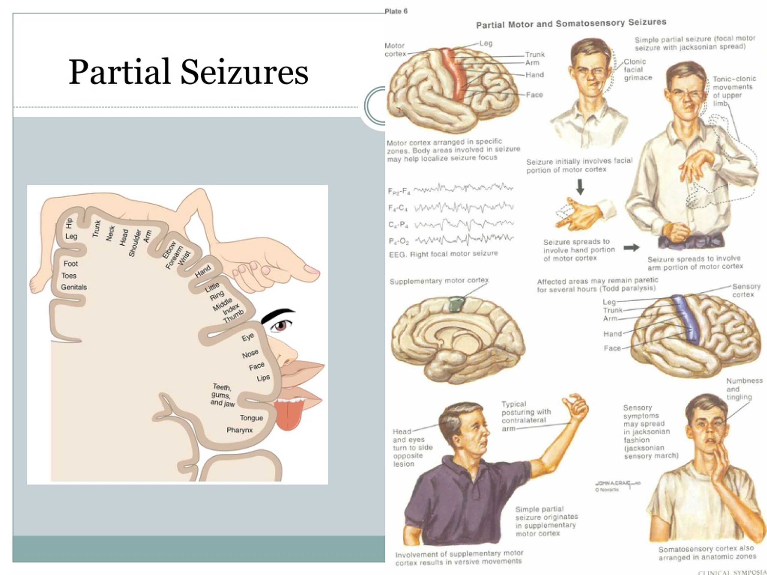 PPT Evaluation and Management of Pediatric Seizures PowerPoint