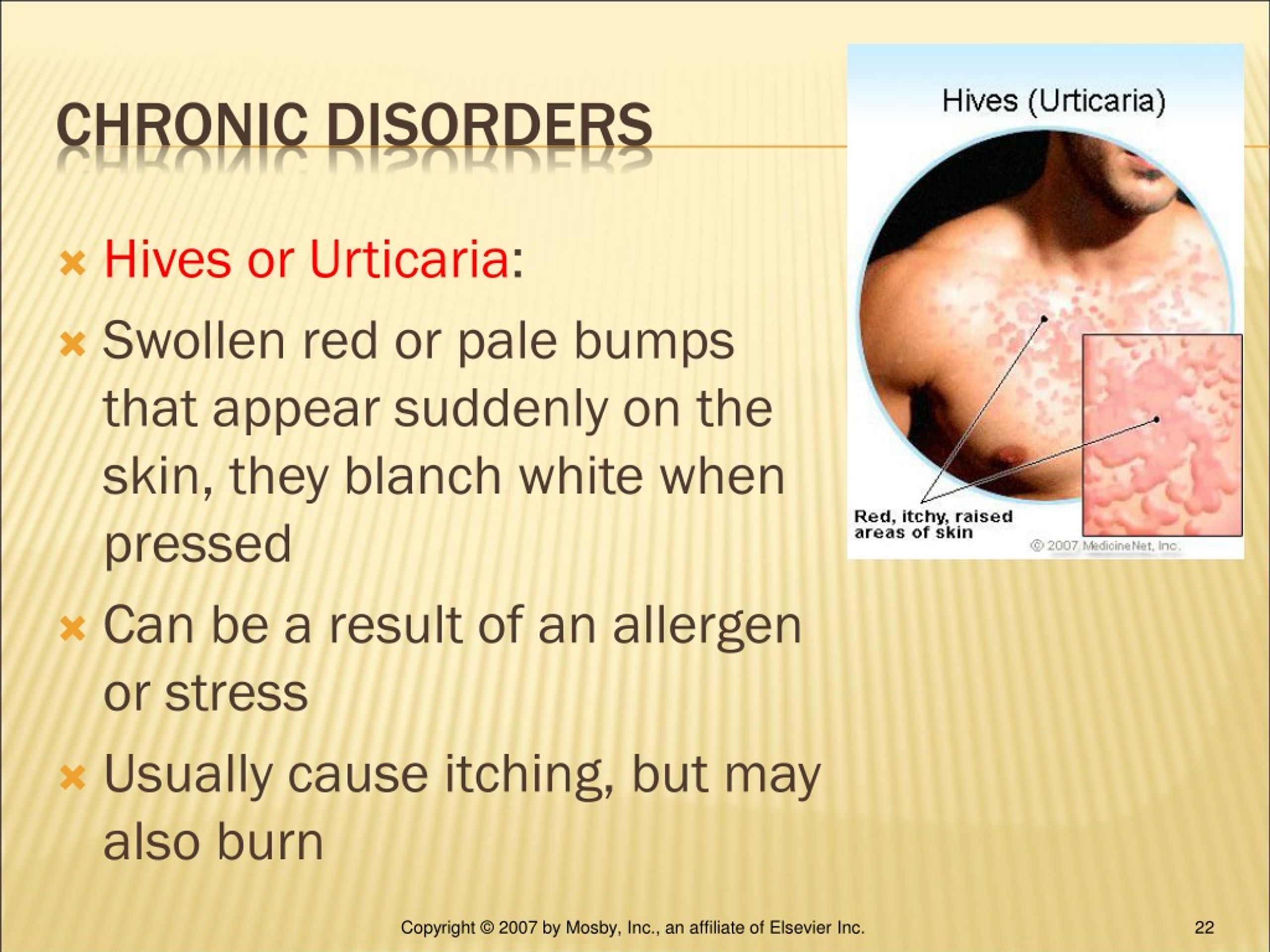 PPT CHAPTER 10 INTEGUMENTARY SYSTEM PowerPoint Presentation, free