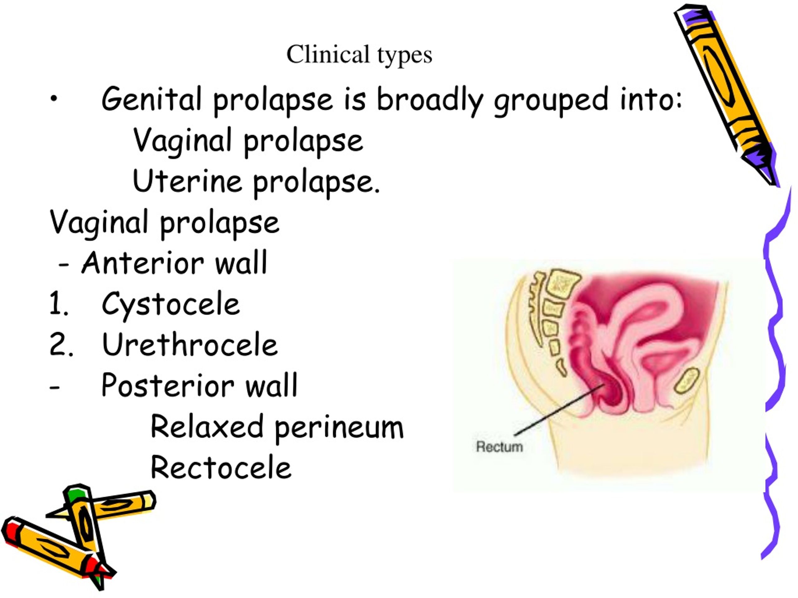 PPT Genital Prolapse PowerPoint Presentation, free download ID325270