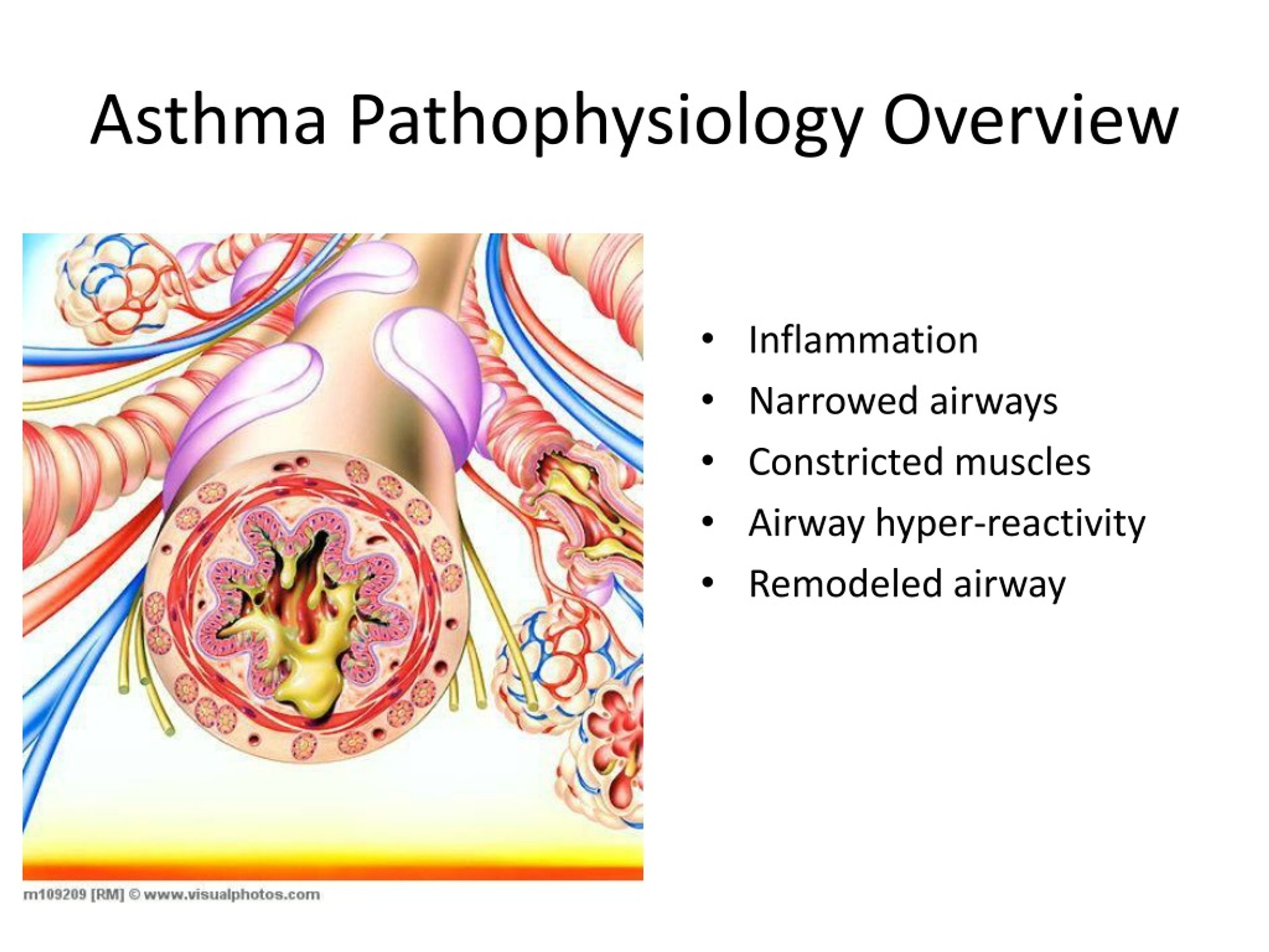PPT Pediatric Asthma PowerPoint Presentation, free download ID349643
