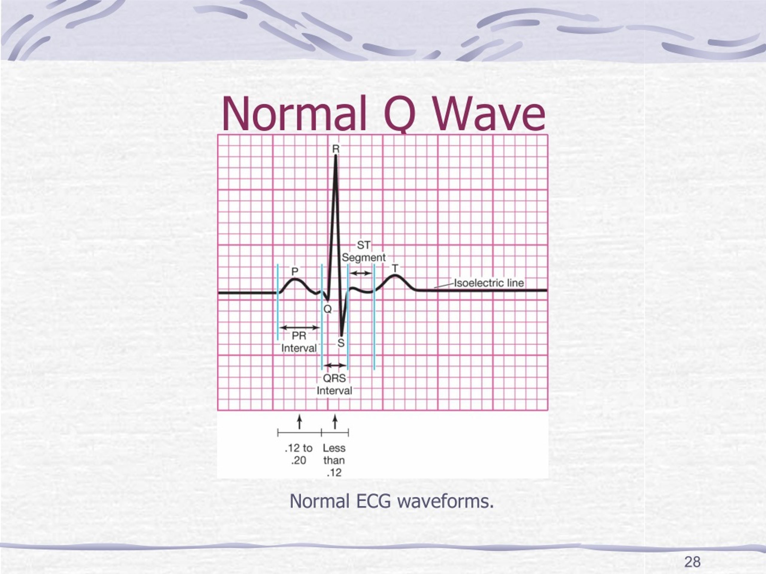 PPT Coronary Artery Disease (CAD) PowerPoint Presentation, free