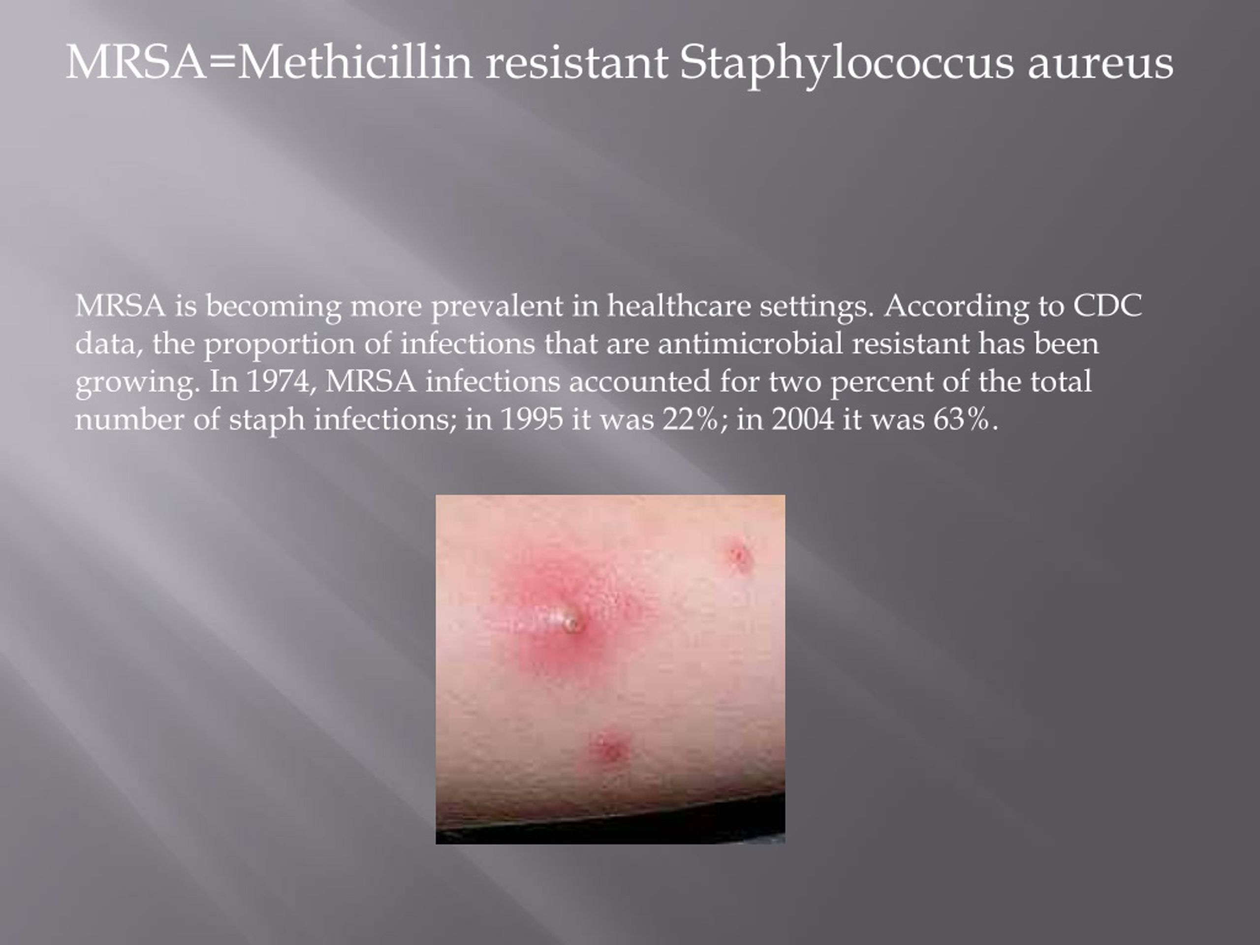 PPT MRSA=Methicillin resistant Staphylococcus aureus PowerPoint
