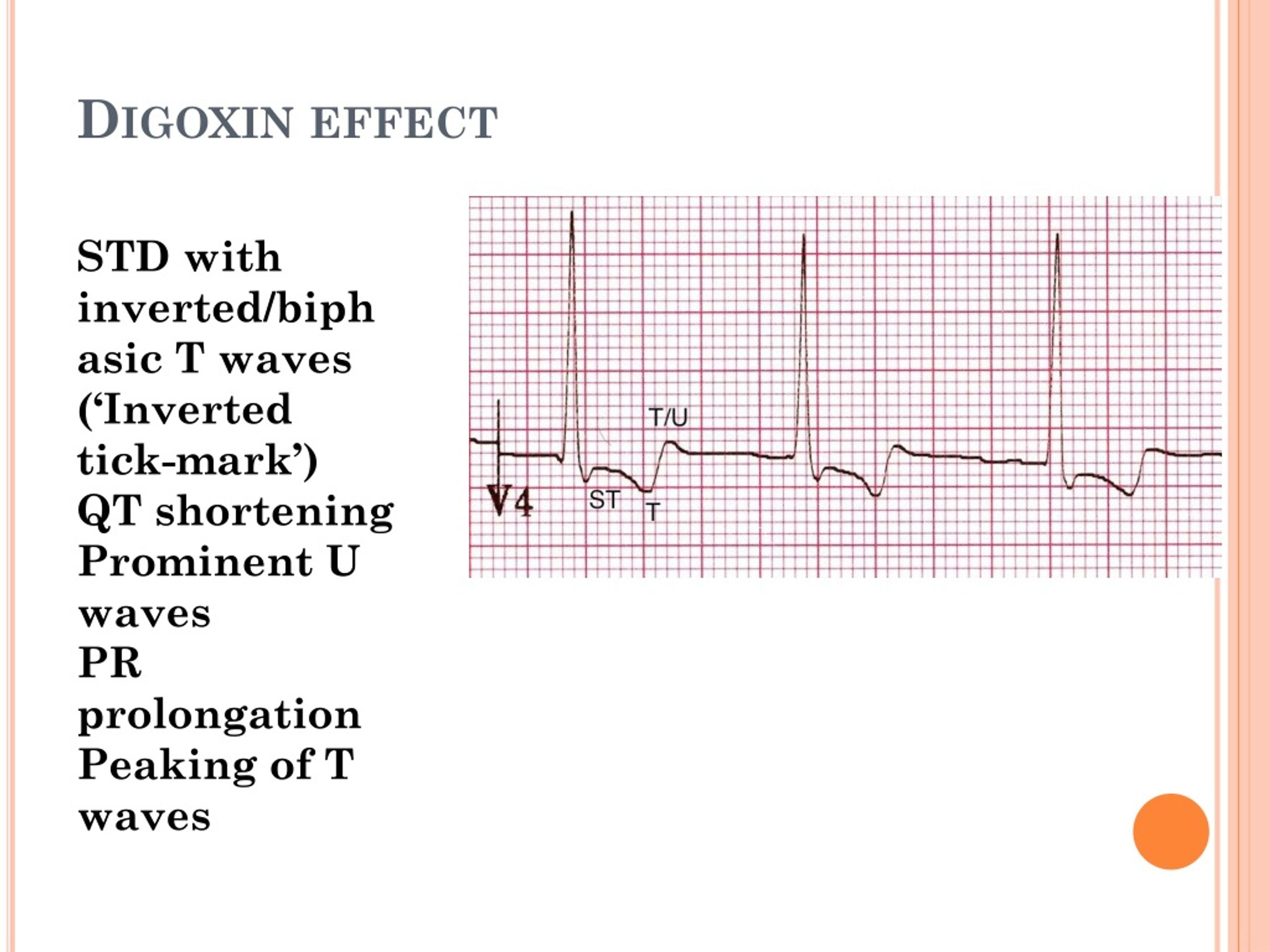 PPT Cardiac Inotropes PowerPoint Presentation, free download ID504059
