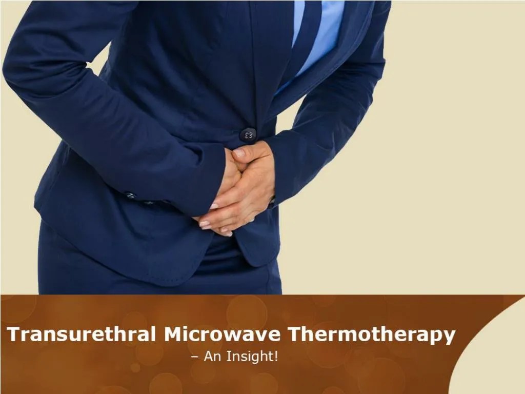 PPT Elevated PSA Treatment Options in Kansas City PowerPoint