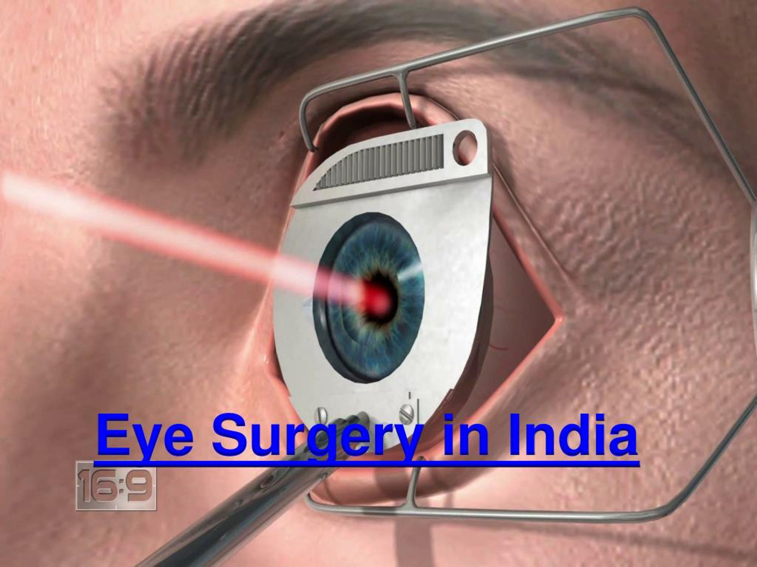 PPT Eye Surgery in India & Eye Treatment in India PowerPoint