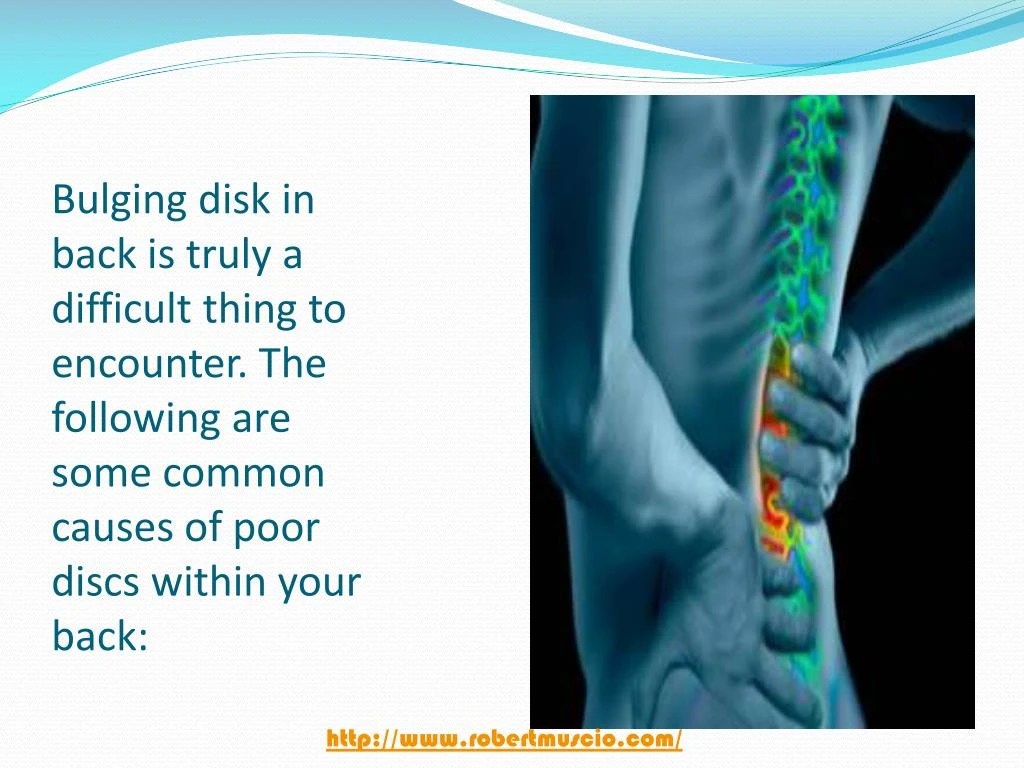 PPT Causes, Symptoms, and Treatment of a Bulging Disc Lower Back
