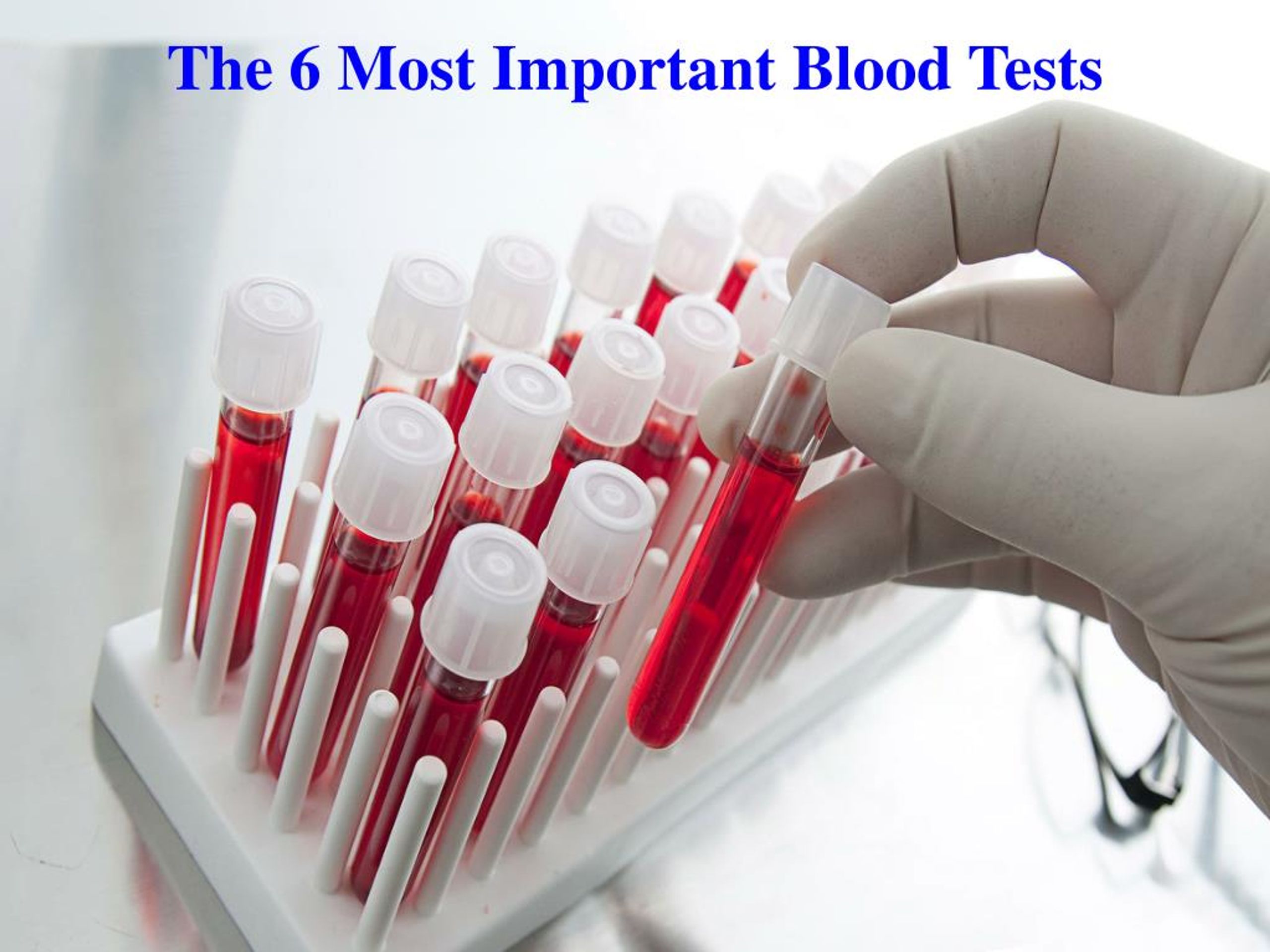 What Are Important Blood Tests For Dialysis Patients at Brian Higgins blog