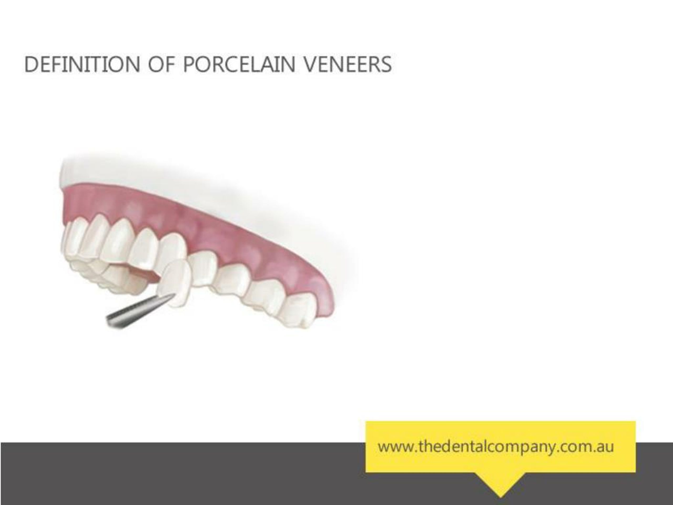 PPT The Four Benefits of Porcelain Veneers PowerPoint Presentation