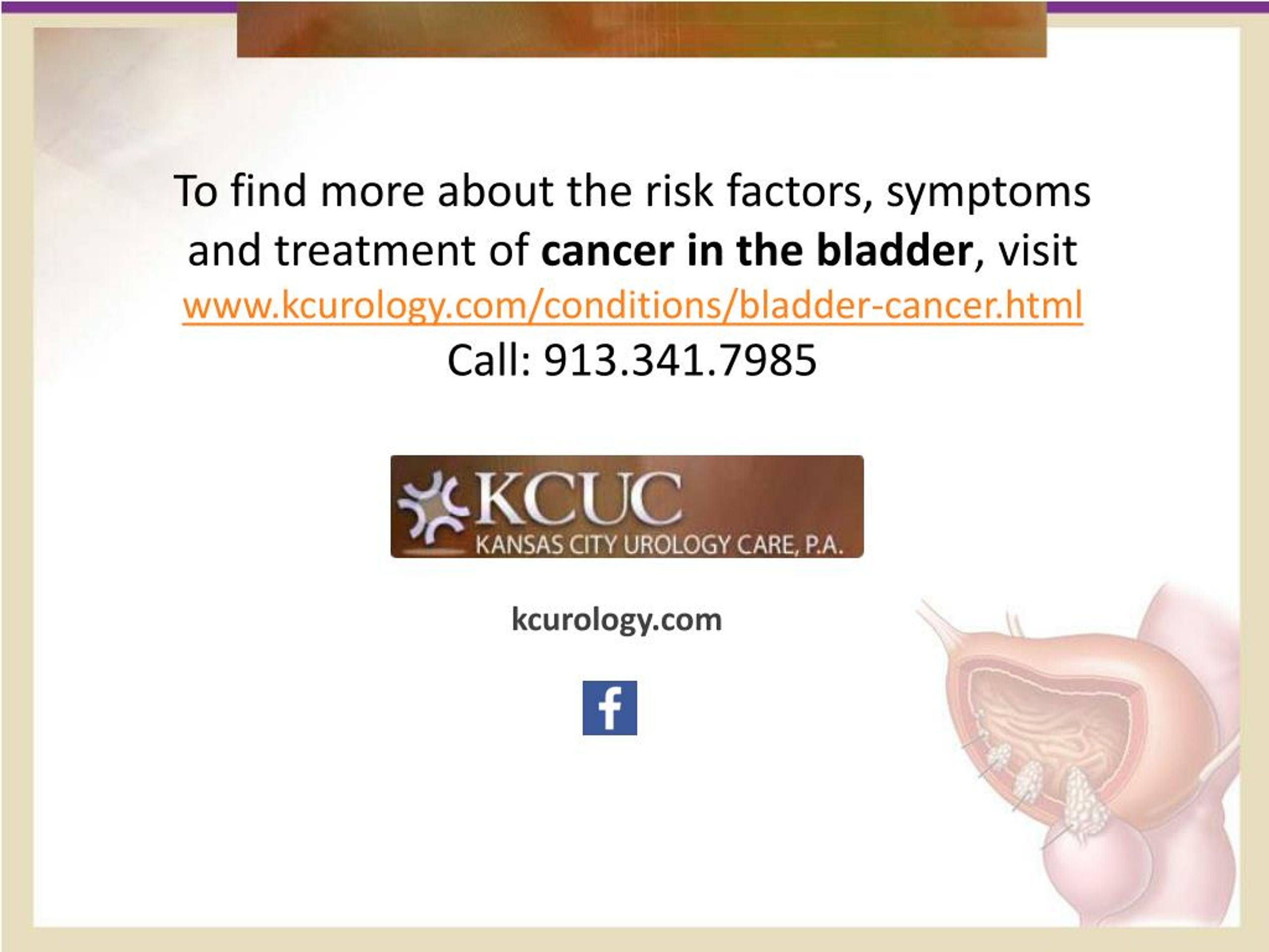 PPT Unbelievable Facts about Cancer in the Bladder PowerPoint